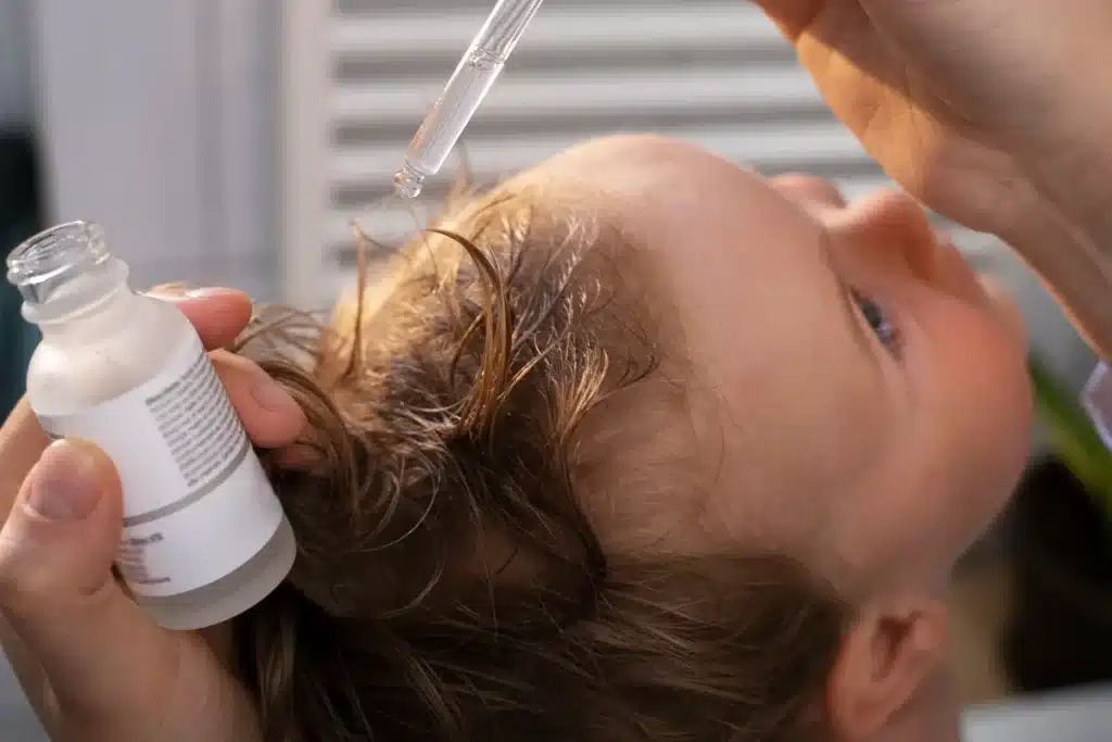 Mãe aplicando óleo essencial no couro cabeludo de um bebê com uma pipeta, destacando os cuidados da aromaterapia infantil.