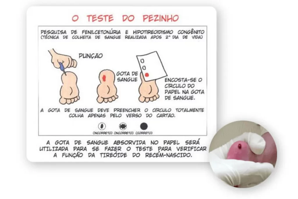 Diagrama e foto ilustrando o procedimento do exame do pezinho para triagem neonatal.
