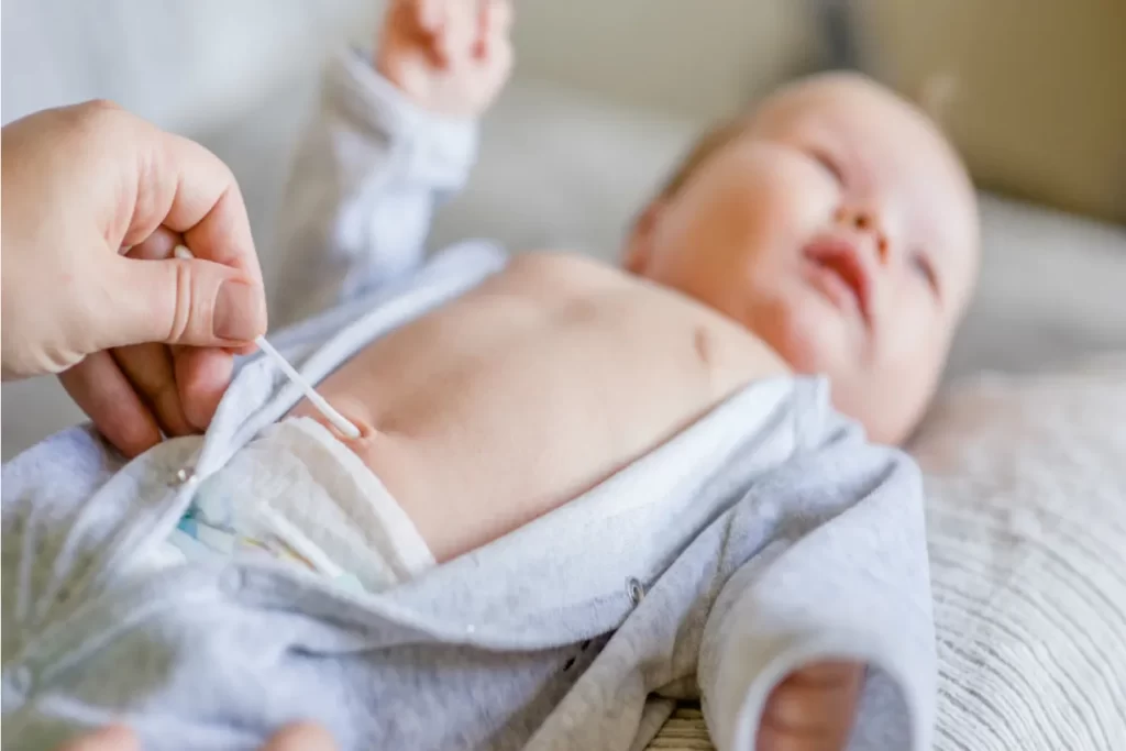 Mão de cuidador limpando delicadamente o coto umbilical de um bebê recém-nascido com um cotonete, destacando os cuidados necessários para a cicatrização.
