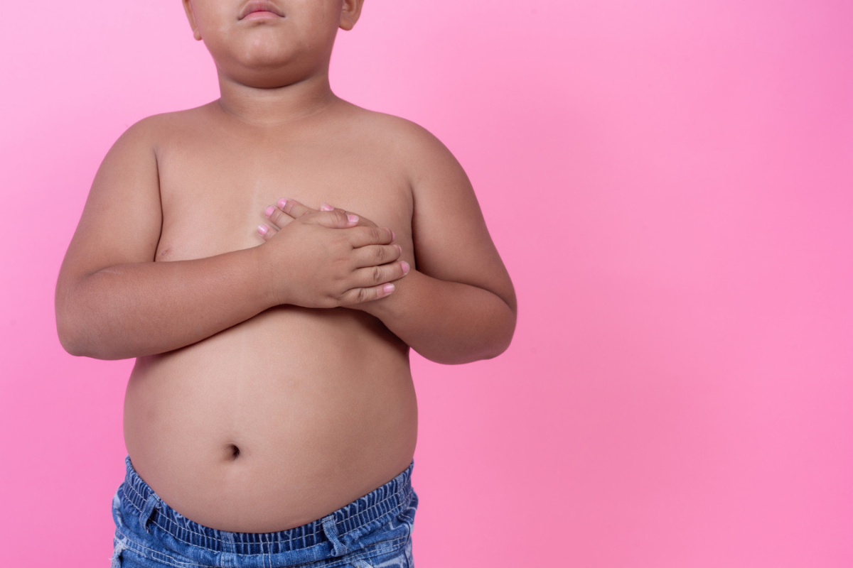 Obesidade infantil: conheça as causas e como tratá-la