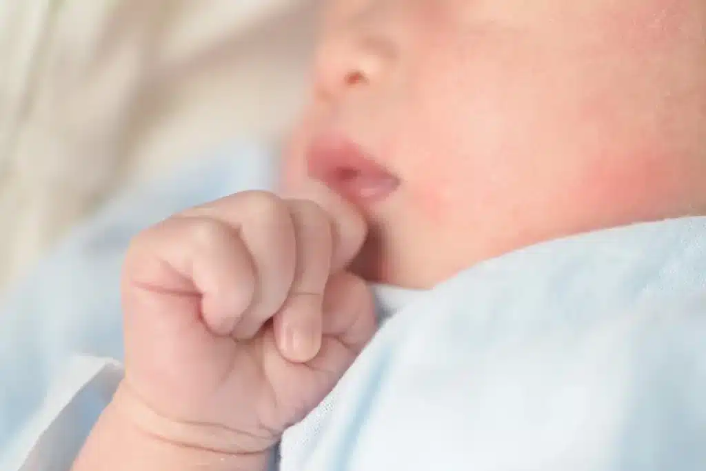 Bebê com bochechas avermelhadas e mão próxima à boca, possível sinal de brotoeja