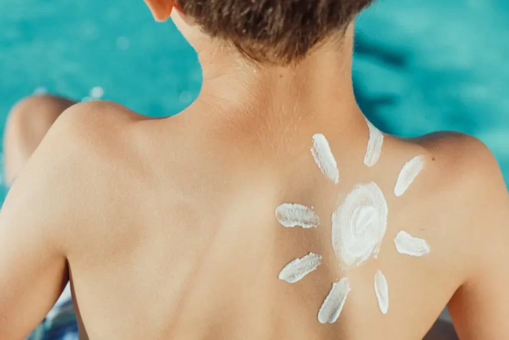 Criança com desenho de sol feito com protetor solar nas costas, simbolizando proteção solar infantil